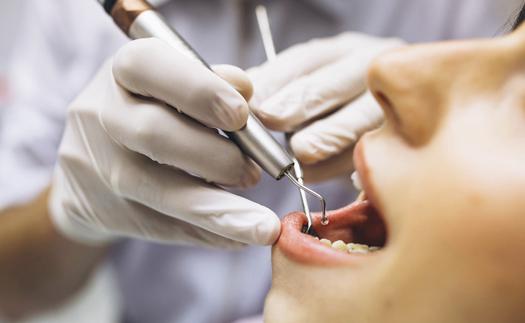 Noticia ¿Qué es una endodoncia?